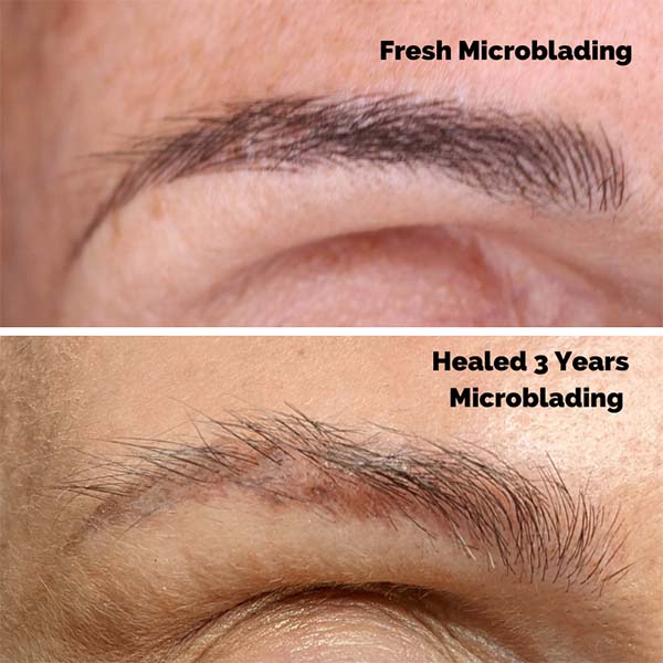 how long does microblading last
