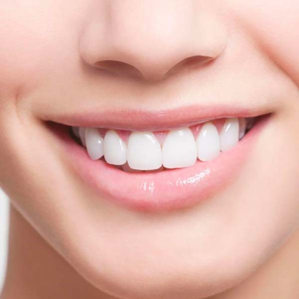 after - teeth whitening course