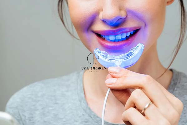 benefits of teeth whitening - at home