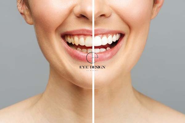 how to get rid of yellow teeth effectively