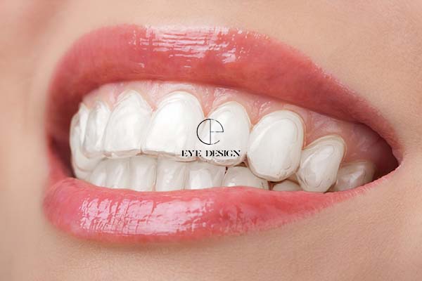 teeth whitening gum